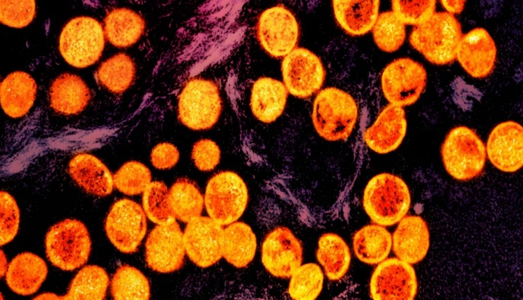 inbound3498639179085053921